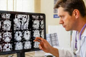 A doctor looks at scans of a brain on a computer