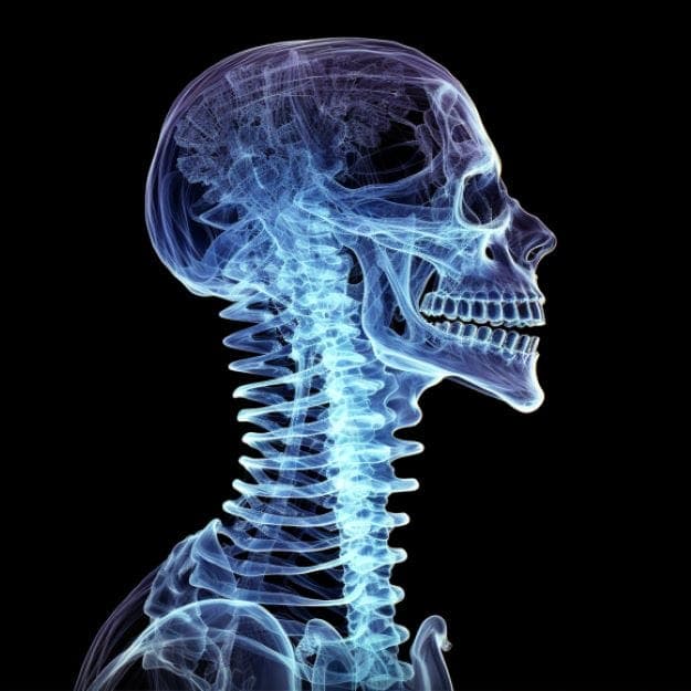 neck xray