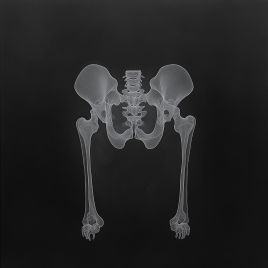 hip bone xray